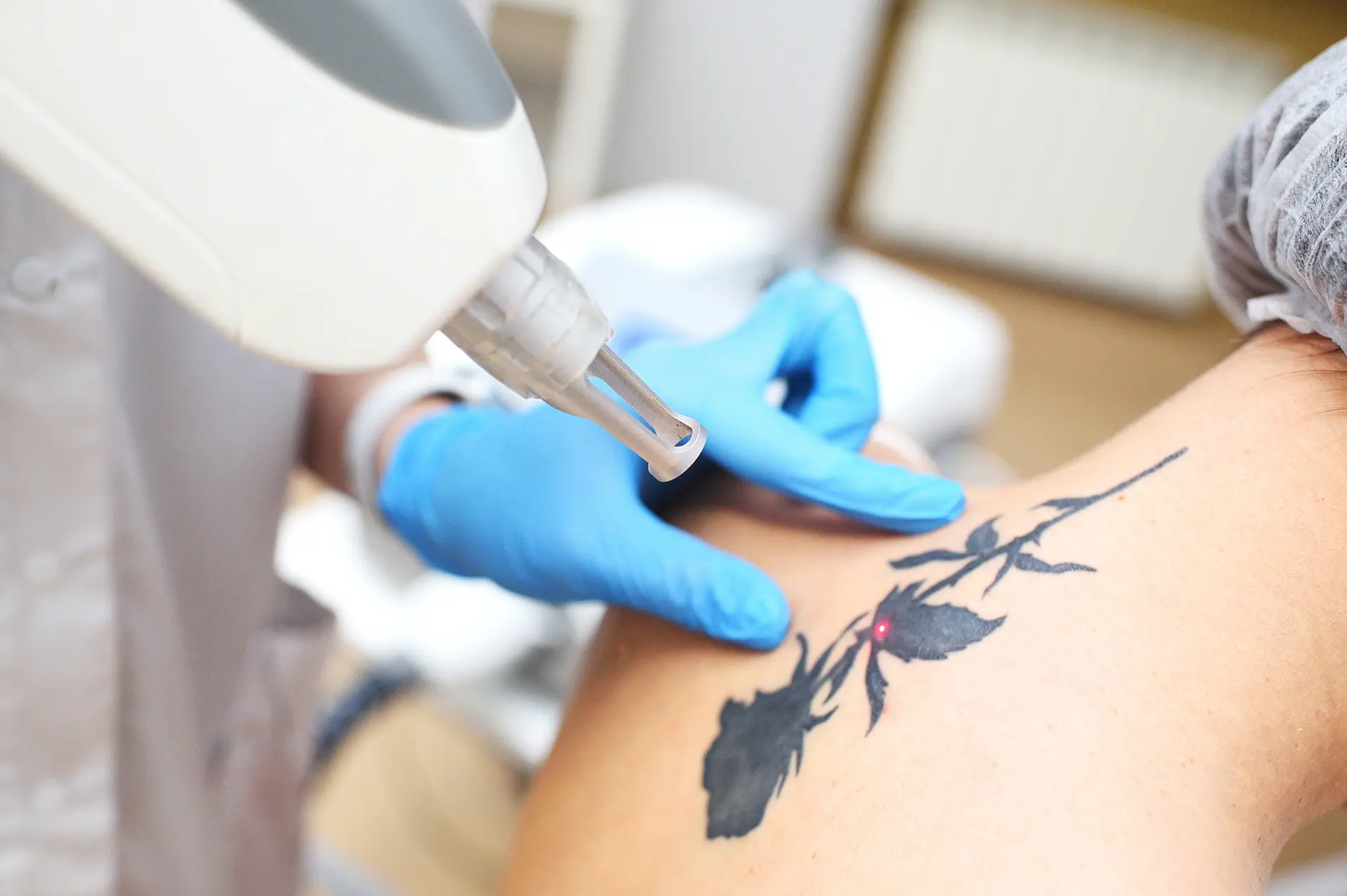 cosmetologist-removes-the-tattoo-to-the-patient-us